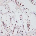 Phospho-SRF (Ser103) Antibody in Immunohistochemistry (Paraffin) (IHC (P))