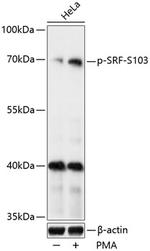 Phospho-SRF (Ser103) Antibody in Western Blot (WB)