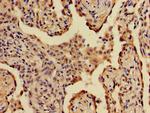 A2ML1 Antibody in Immunohistochemistry (Paraffin) (IHC (P))