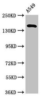 A2ML1 Antibody in Western Blot (WB)