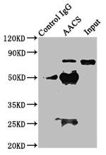 AACS Antibody in Western Blot (WB)