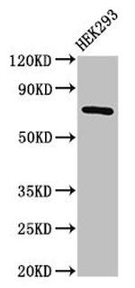 AACS Antibody in Western Blot (WB)