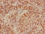 ACADL Antibody in Immunohistochemistry (Paraffin) (IHC (P))