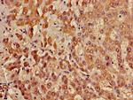 ACADL Antibody in Immunohistochemistry (Paraffin) (IHC (P))