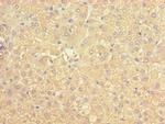 ACADS Antibody in Immunohistochemistry (Paraffin) (IHC (P))