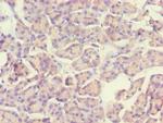 ACADS Antibody in Immunohistochemistry (Paraffin) (IHC (P))