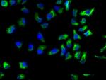 alpha Actinin 1 Antibody in Immunocytochemistry (ICC/IF)