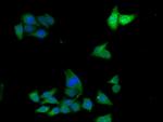 ADH7 Antibody in Immunocytochemistry (ICC/IF)