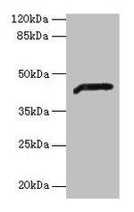 ADH7 Antibody in Western Blot (WB)