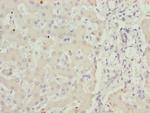 ADPGK Antibody in Immunohistochemistry (Paraffin) (IHC (P))