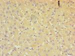 ALDH4A1 Antibody in Immunohistochemistry (Paraffin) (IHC (P))