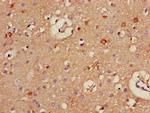 ALDH5A1 Antibody in Immunohistochemistry (Paraffin) (IHC (P))