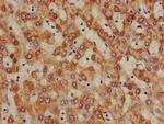 ALDH5A1 Antibody in Immunohistochemistry (Paraffin) (IHC (P))