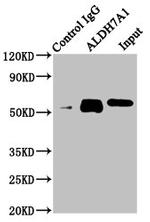 ALDH7A1 Antibody in Western Blot (WB)