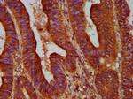 ALOX12 Antibody in Immunohistochemistry (Paraffin) (IHC (P))