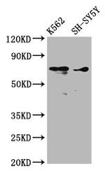 ALOX12 Antibody in Western Blot (WB)