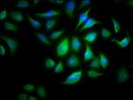 ALOX15B Antibody in Immunocytochemistry (ICC/IF)