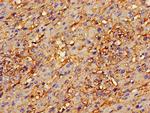 Annexin A2 Antibody in Immunohistochemistry (Paraffin) (IHC (P))