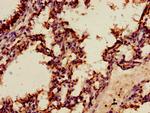 Annexin A2 Antibody in Immunohistochemistry (Paraffin) (IHC (P))