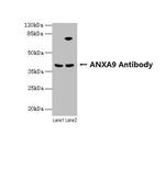 Annexin A9 Antibody in Western Blot (WB)