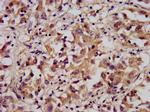 ARL1 Antibody in Immunohistochemistry (Paraffin) (IHC (P))