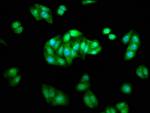 beta Arrestin 1 Antibody in Immunocytochemistry (ICC/IF)