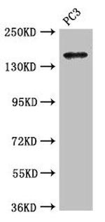 ASTN2 Antibody in Western Blot (WB)