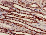 ATP Synthase beta Antibody in Immunohistochemistry (Paraffin) (IHC (P))