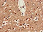 ATP9A Antibody in Immunohistochemistry (Paraffin) (IHC (P))