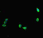 Aurora A Antibody in Immunocytochemistry (ICC/IF)