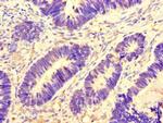 Aurora A Antibody in Immunohistochemistry (Paraffin) (IHC (P))