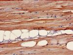 B3GALT4 Antibody in Immunohistochemistry (Paraffin) (IHC (P))