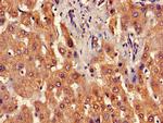 B3GNT2 Antibody in Immunohistochemistry (Paraffin) (IHC (P))