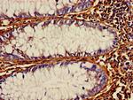 PDI Antibody in Immunohistochemistry (Paraffin) (IHC (P))