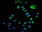 p130Cas Antibody in Immunocytochemistry (ICC/IF)