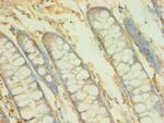 BCAT2 Antibody in Immunohistochemistry (Paraffin) (IHC (P))