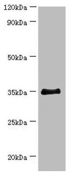 BCAT2 Antibody in Western Blot (WB)