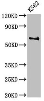 Butyrylcholinesterase Antibody in Western Blot (WB)