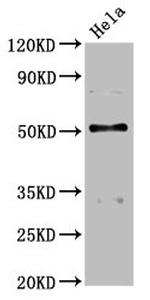 BCKDHA Antibody in Western Blot (WB)