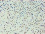 BCKDK Antibody in Immunohistochemistry (Paraffin) (IHC (P))