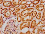 BCL9 Antibody in Immunohistochemistry (Paraffin) (IHC (P))