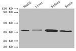 BDH1 Antibody in Western Blot (WB)