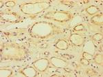 BRCC3 Antibody in Immunohistochemistry (Paraffin) (IHC (P))