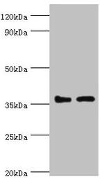 BRCC3 Antibody in Western Blot (WB)