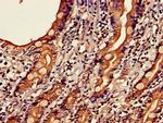 C19orf47 Antibody in Immunohistochemistry (Paraffin) (IHC (P))