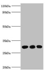 Carbonic Anhydrase I Antibody in Western Blot (WB)