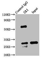 Carbonic Anhydrase I Antibody in Western Blot (WB)