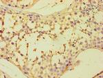 CAPZB Antibody in Immunohistochemistry (Paraffin) (IHC (P))