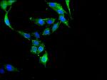 c-Cbl Antibody in Immunocytochemistry (ICC/IF)