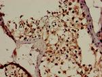 c-Cbl Antibody in Immunohistochemistry (Paraffin) (IHC (P))